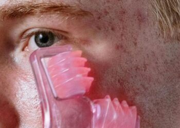 Top 5 tips to prevent acne breakouts
                              
                              Published by Livemint | 10 Sep 2024