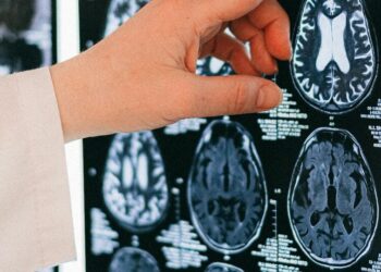 7 foods you should never eat for a healthy brain
                              
                              Published by Livemint | 26 Oct 2024