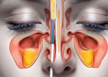 5 home remedies for sinus infections
                              
                              Published by Livemint | 12 Nov 2024