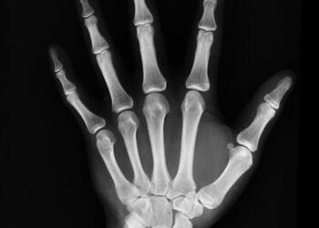 5 essential nutrients for stronger bones
                              
                              Published by Livemint | 04 Nov 2024