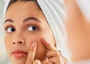 5 tips to avoid and treat acne naturally
                              
                              Published by Livemint | 04 Nov 2024