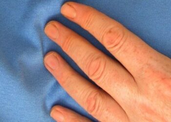 5 superfoods that will keep your heart healthy
                              
                              Published by Livemint | 27 Dec 2024