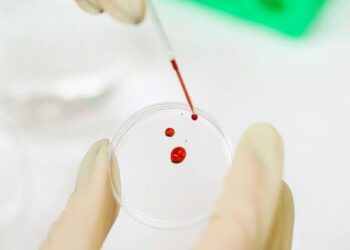 5 superfoods to increase platelet visual story
                              
                              Published by Livemint | 14 Dec 2024